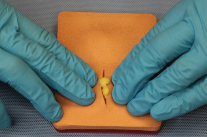 Product Insight: I&D Simulated Cyst/Abscess Tissue Pad