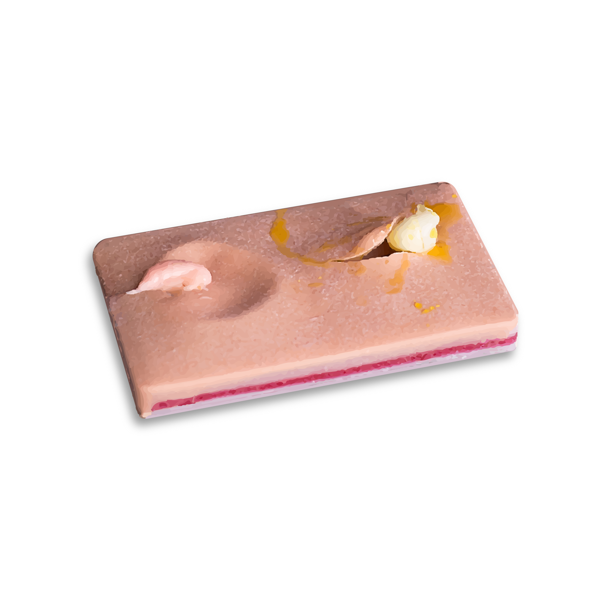 SurgiReal's I&D Suture Pad helps students learn how to incise and drain cysts and abscesses. Includes a simulated cyst that can burst and simulated puss to be removed from the pad, packed, and then sutured.